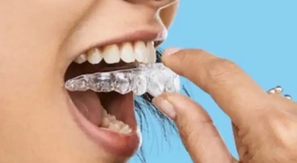 SmileDirectClub officially takes the (dental) crown as the worst IPO of 2019