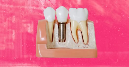 teeth