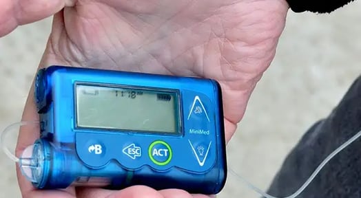 Just 3 companies own the global insulin market, and they’re all allergic to fair prices 