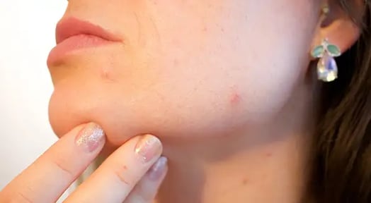 What’s with the rash of private equity in dermatology practices these days?