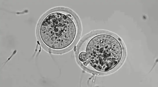 Human egg donations are a lucrative business… but it’s not always as egg-vertised