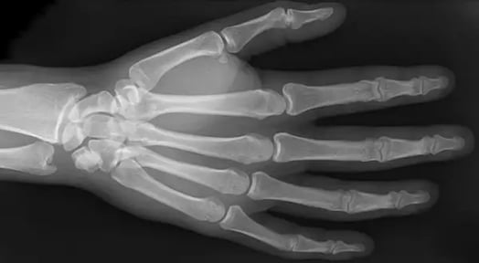 Tech companies are betting that skin is the next frontier in the checkout aisle